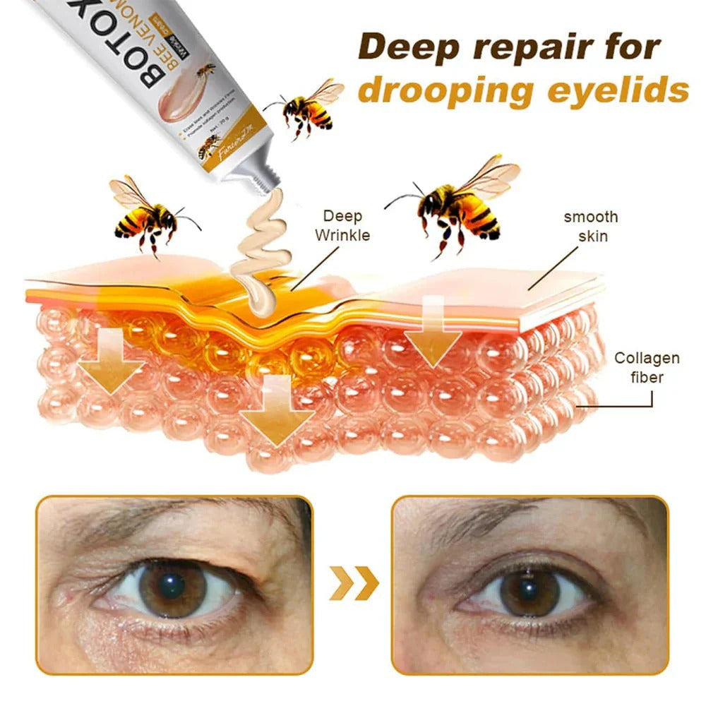 Botox Bee Venom Wrinkle Removal Cream